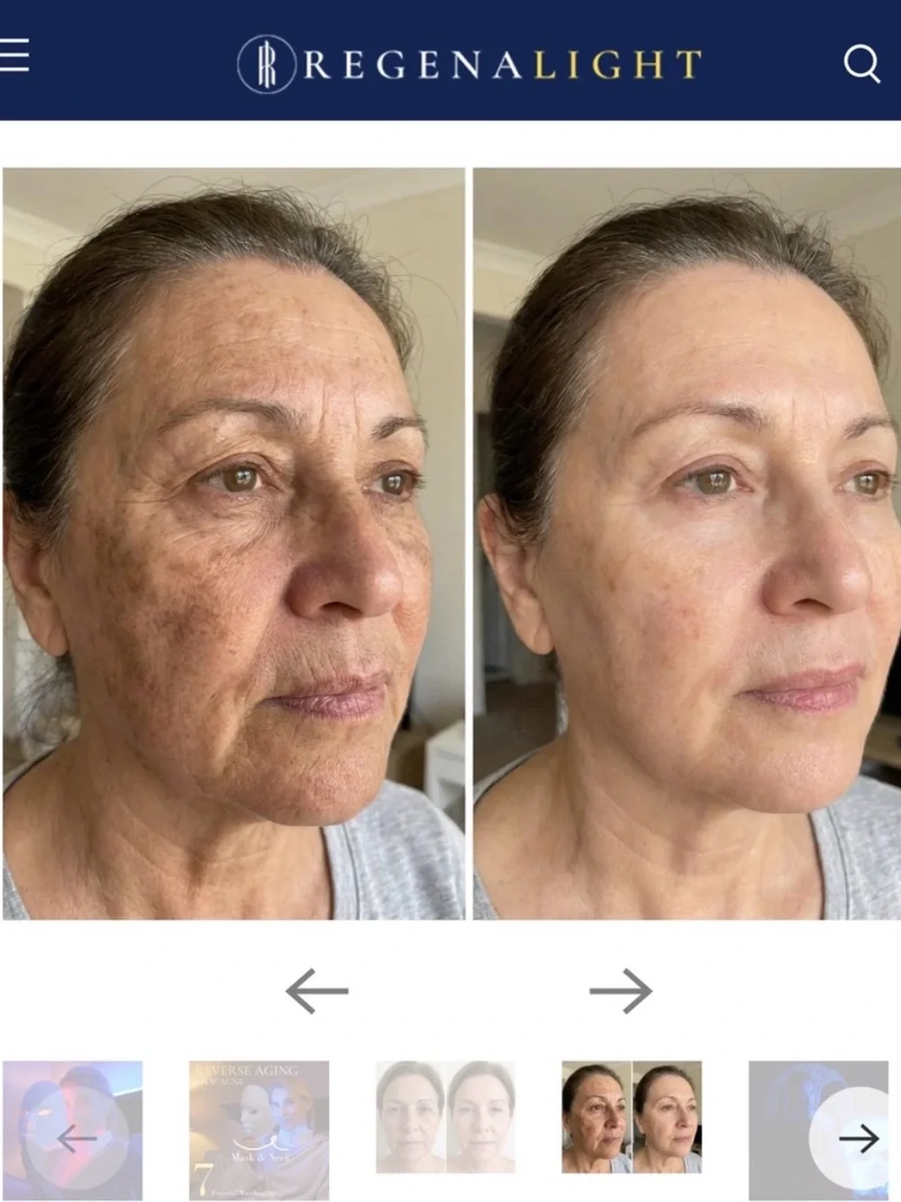 LED Light Therapy Face Mask - White by